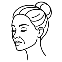 Smile Lines (Nasolabial)-200×200 copy