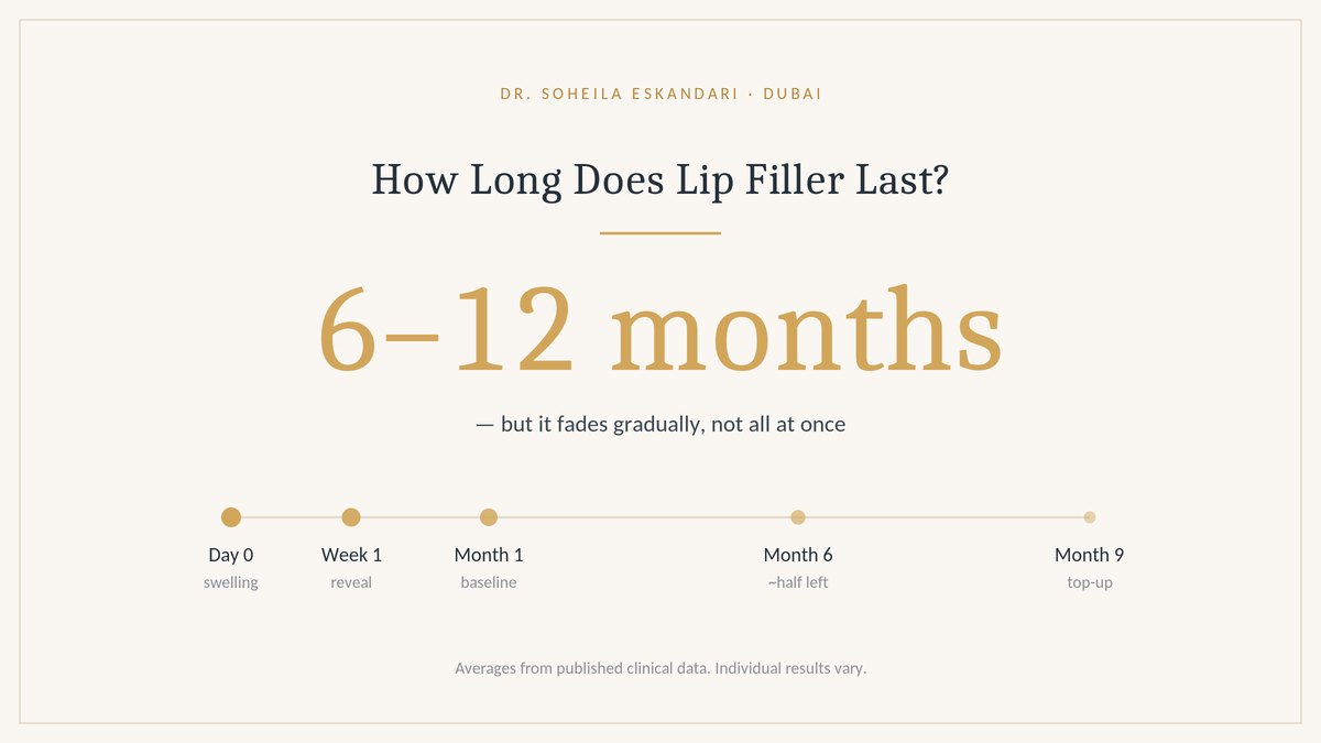 How long does lip filler last: 6 to 12 months, fading gradually from day 0 through month 9
