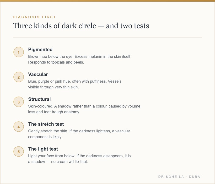 The three types of dark circles and two self-tests to identify them