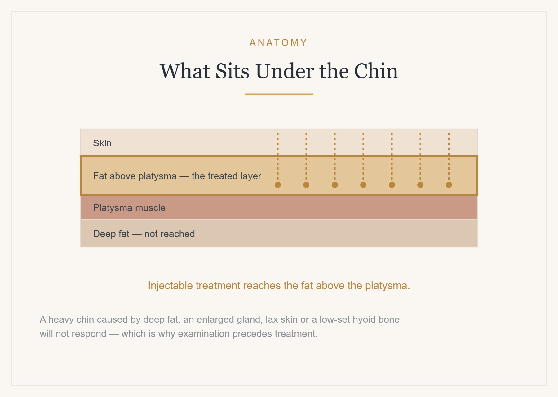 What sits under the chin: skin, fat above and below the platysma, and the muscle itself