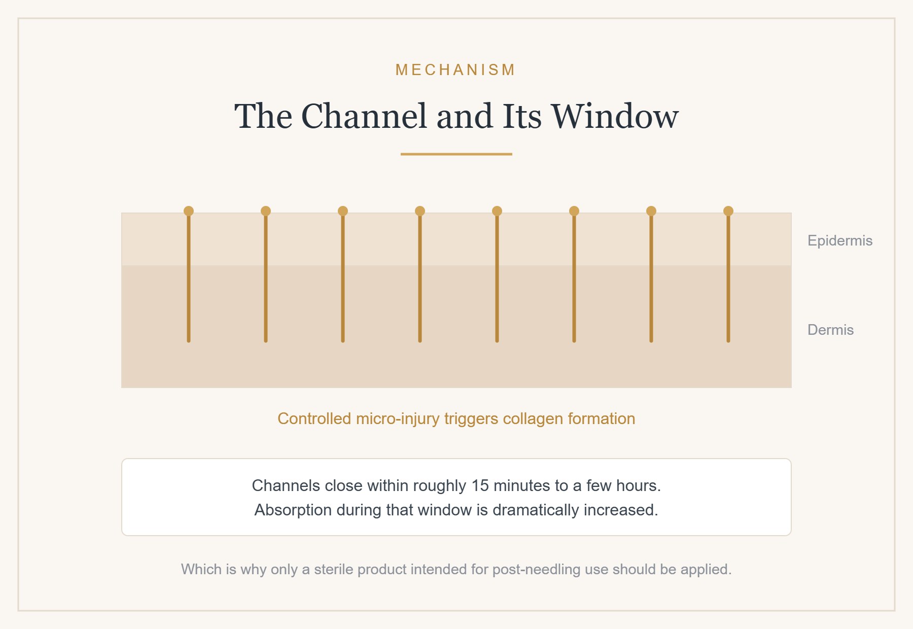 What a microneedle actually does to skin, and how long the channels stay open