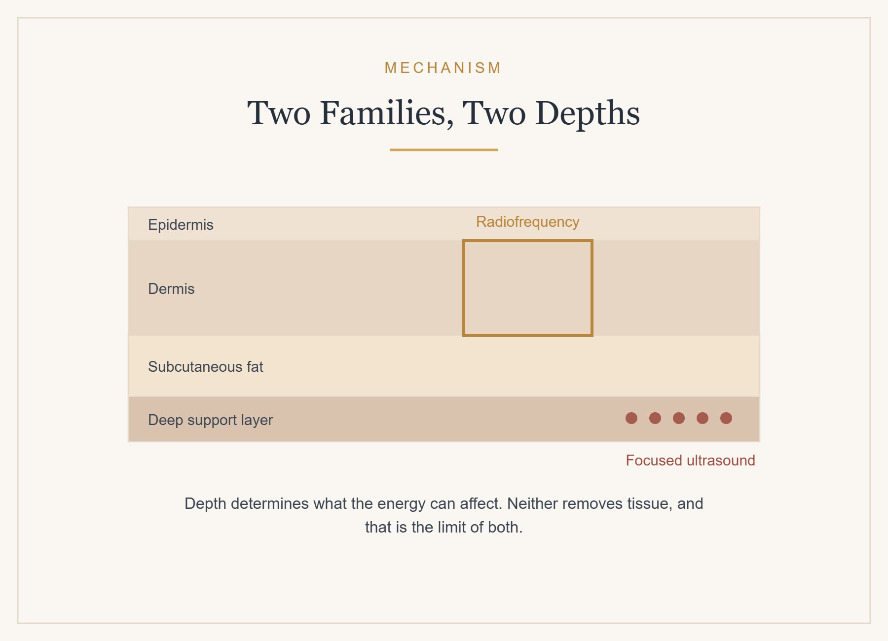 How focused ultrasound and radiofrequency reach different depths